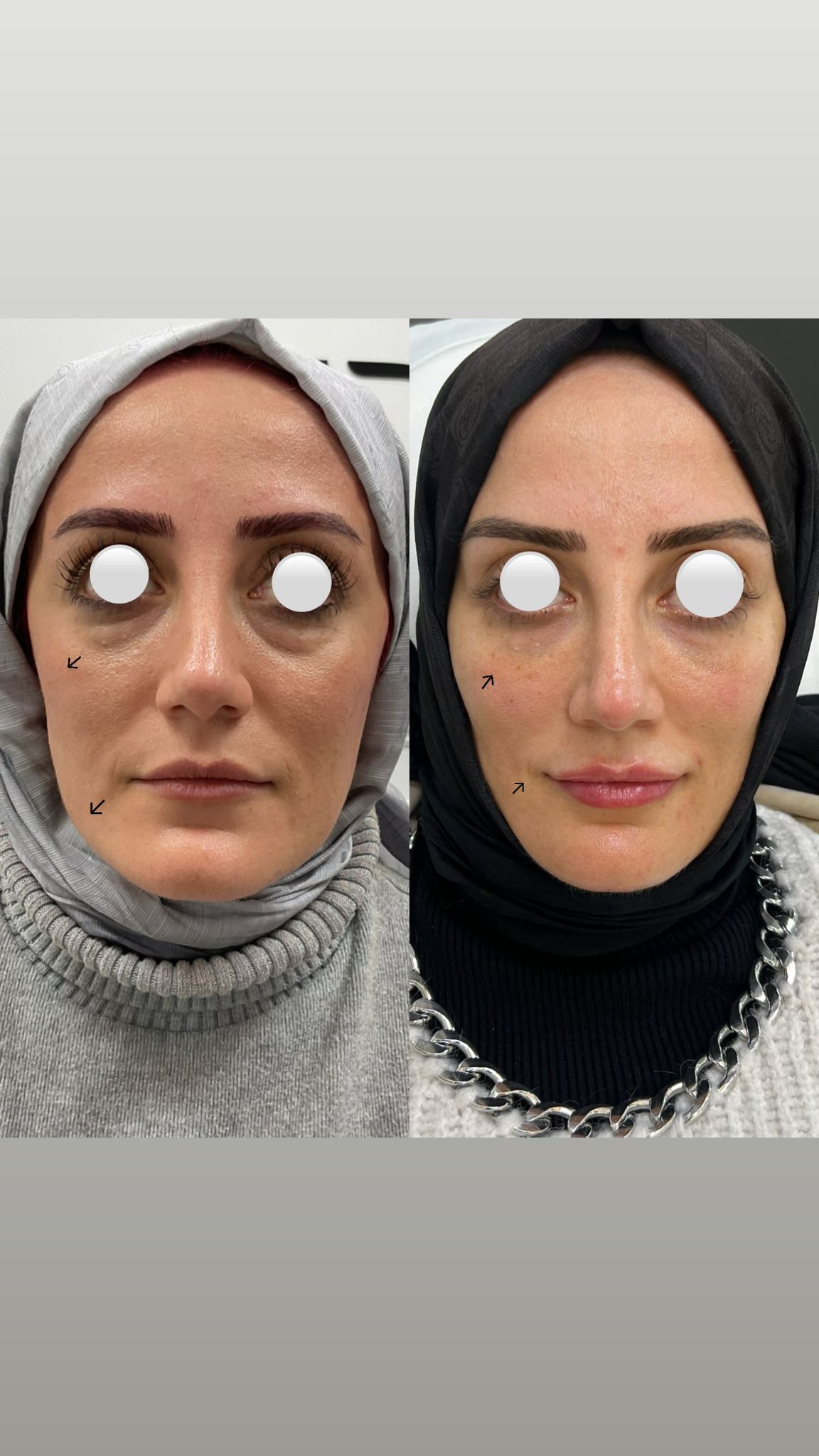 Before and after aesthetic procedure results