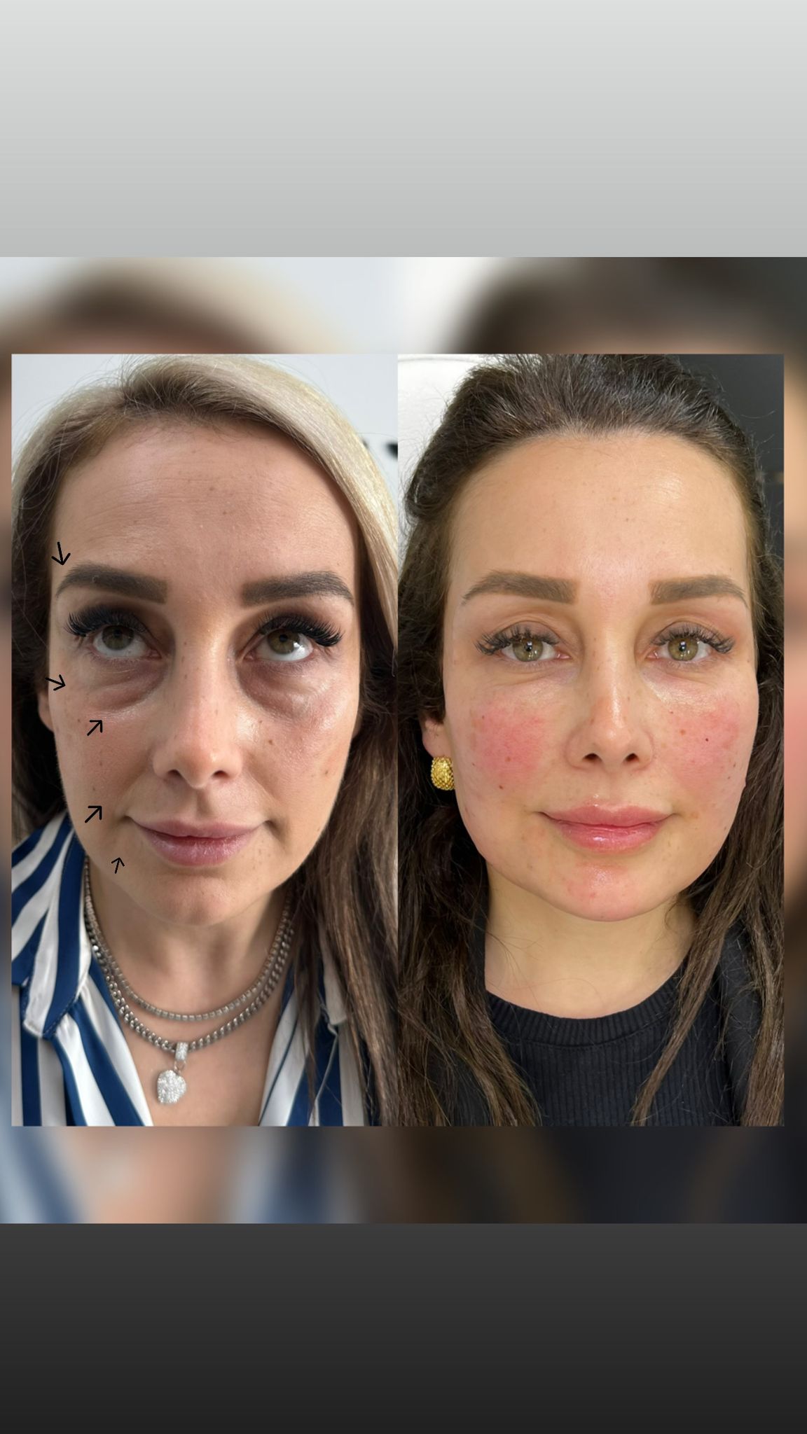 Skin renewal results