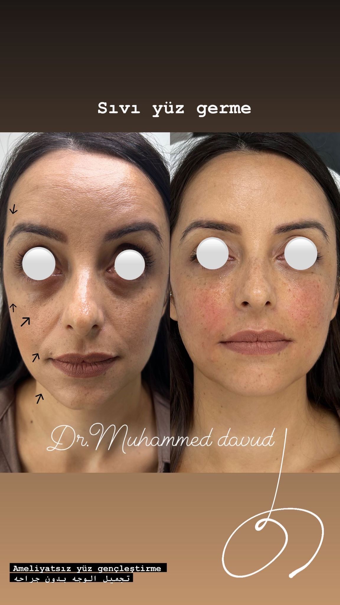 Premium aesthetic care results